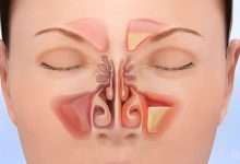 Home remedies for sinus infection apple cider vinega