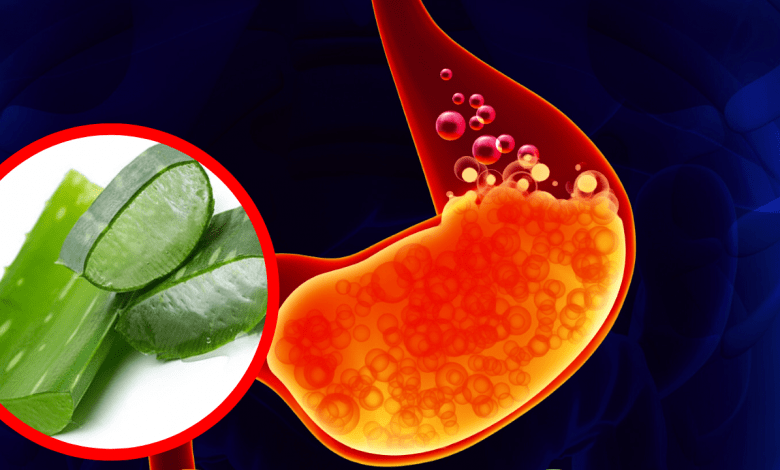 10 Home Remedies for Heartburn That Actually Work